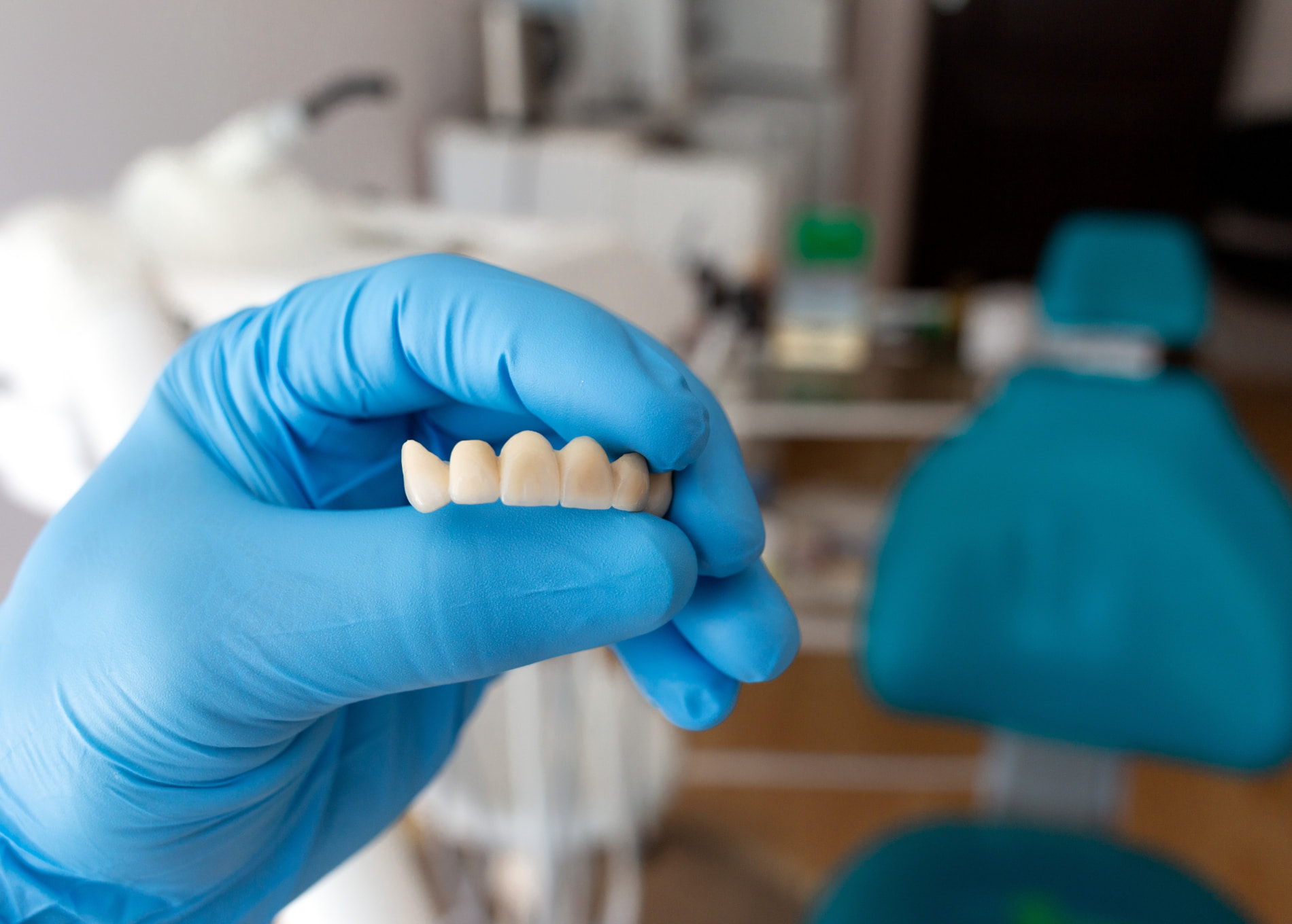 Maintaining Dental Bridges: A Step-by-Step Care Guide – Telegraph