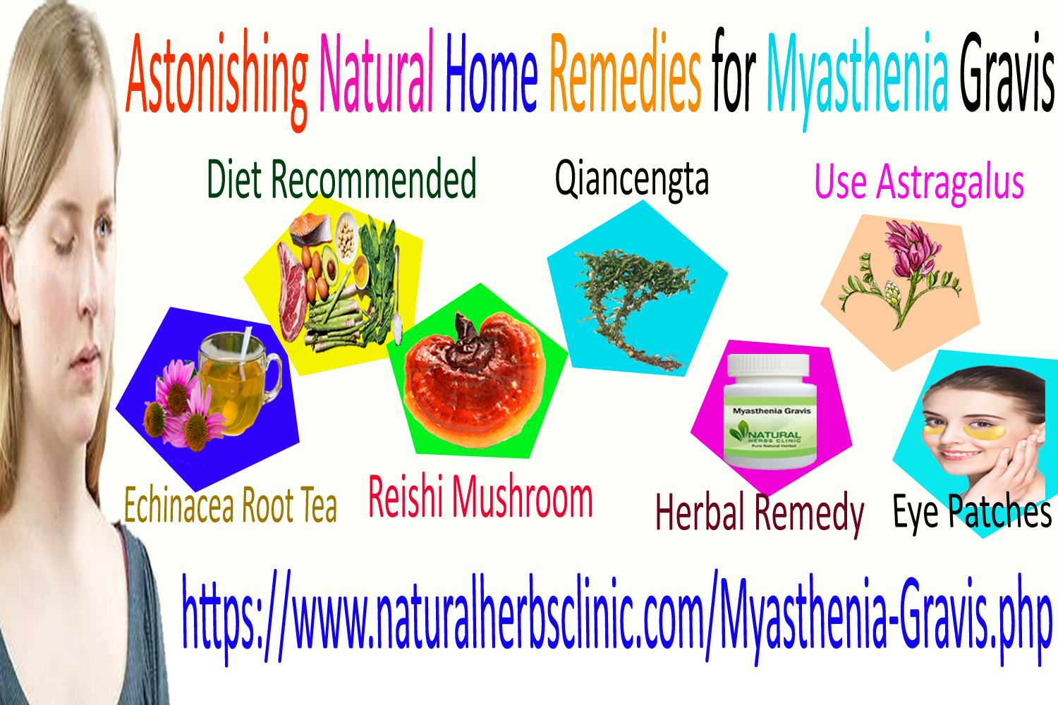 6 Astonishing Natural Home Remedies for Myasthenia Gravis