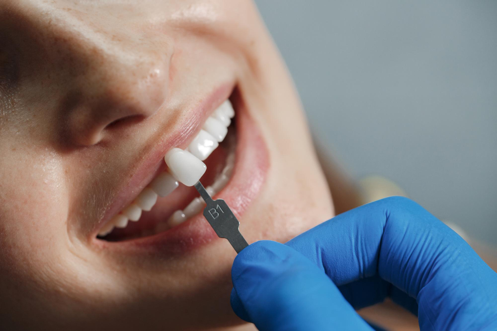 Arch Dental Implants in Mullica Hills | Expert Care